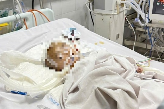 Quảng Ngãi tổng rà soát các điểm giữ trẻ sau vụ bé 14 tháng tuổi nghi xuất huyết não tại cơ sở tự phát