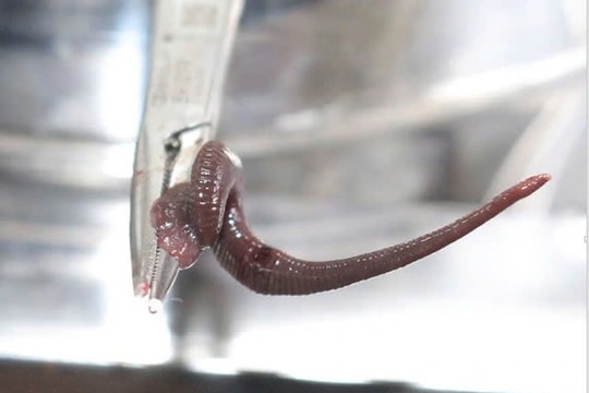 Gia Lai: Gắp con vắt dài 8cm sống trong mũi bệnh nhân suốt một tuần