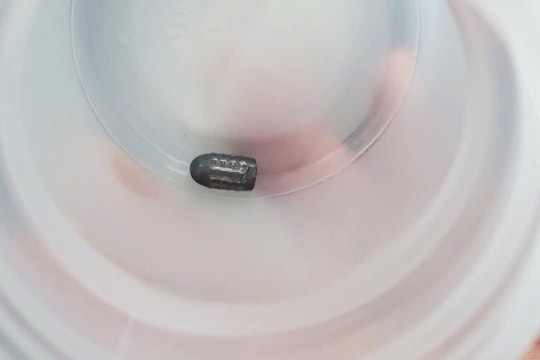 Người phụ nữ bị đạn lạc găm vào đầu khi đang làm vườn