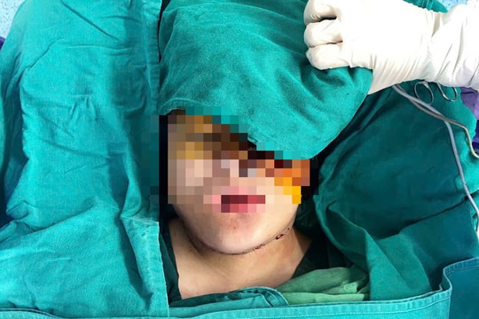 9 giờ phẫu thuật miễn phí cứu thiếu nữ Mông mang khối u khổng lồ