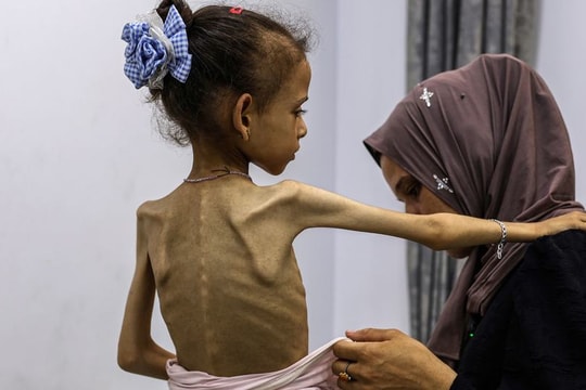 Nạn đói ở Gaza: 'Thảm họa nhân đạo chưa từng có' và 'thử thách của toàn nhân loại'