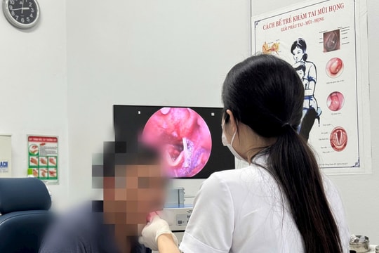 Gắp thành công xương cá dài 4,5 cm cắm sâu ở hạ họng bệnh nhân