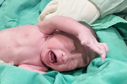 Kỳ tích y khoa: Cứu cả mẹ và con trong ca ung thư cổ tử cung khi mang thai