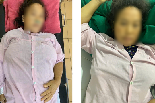 Hồi chuông cảnh báo: Thai phụ người Mông suýt mất mạng vì phá thai không an toàn