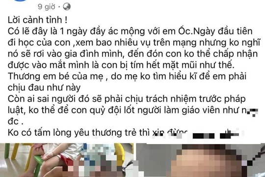 Mẹ bé 4 tuổi bị giáo viên mầm non bạo hành ở Bắc Ninh: 'Vì lo kiếm tiền để con phải chịu đau cả thể xác lẫn tinh thần'