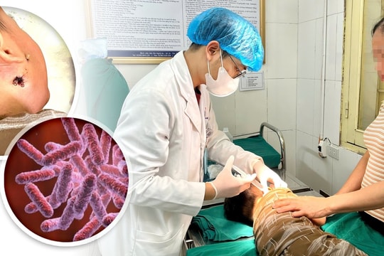 Bé 4 tuổi thoát chết vì vi khuẩn ăn thịt người