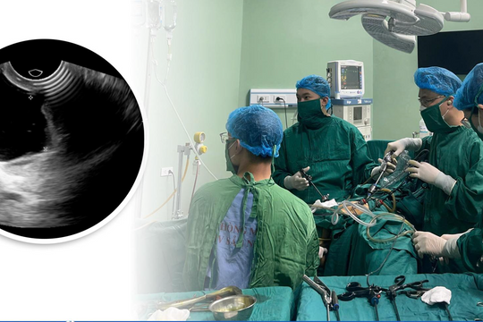 Suýt mất khả năng làm mẹ vì khối u hiếm gặp