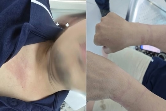 Phóng viên VOV Giao thông bị còng tay khi tác nghiệp tại hiện trường vụ cháy