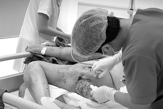 Từ nốt mụn nhỏ ở mông, bệnh nhân 76 tuổi suýt mất mạng vì nhiễm tụ cầu vàng 'siêu kháng thuốc'