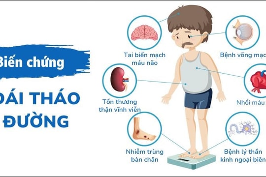 Bệnh tháo đường ở Việt Nam ngày càng trẻ hóa, trẻ 14-15 tuổi đã mắc bệnh