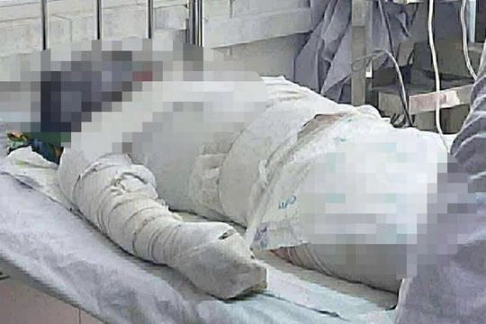 Gia Lai: Thêm 1 người nguy kịch trong vụ cháy nhà lúc rạng sáng, nghi do mâu thuẫn tình cảm