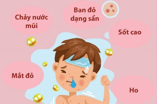 Nhiều quốc gia châu Mỹ sắp mất danh hiệu 'loại trừ bệnh sởi'