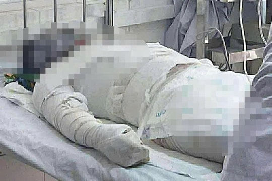 Vụ phóng hỏa đốt nhà nghi do ghen tuông ở Gia Lai: Người chồng đã tử vong