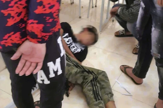 Nam sinh lớp 10 bị nhóm học sinh lớp 11 đánh xuất huyết não, tiên lượng xấu