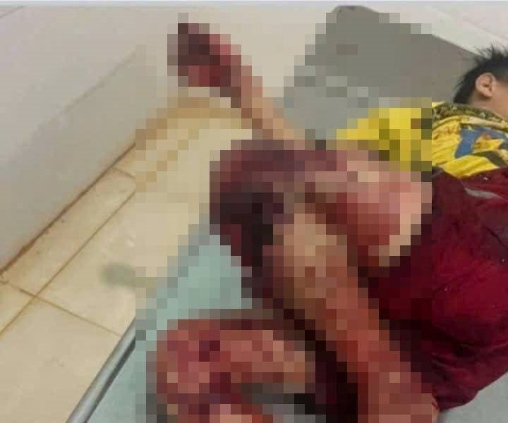 Gia Lai: Mua nguyên liệu về nhà tự chế tạo pháo, 4 học sinh bị thương