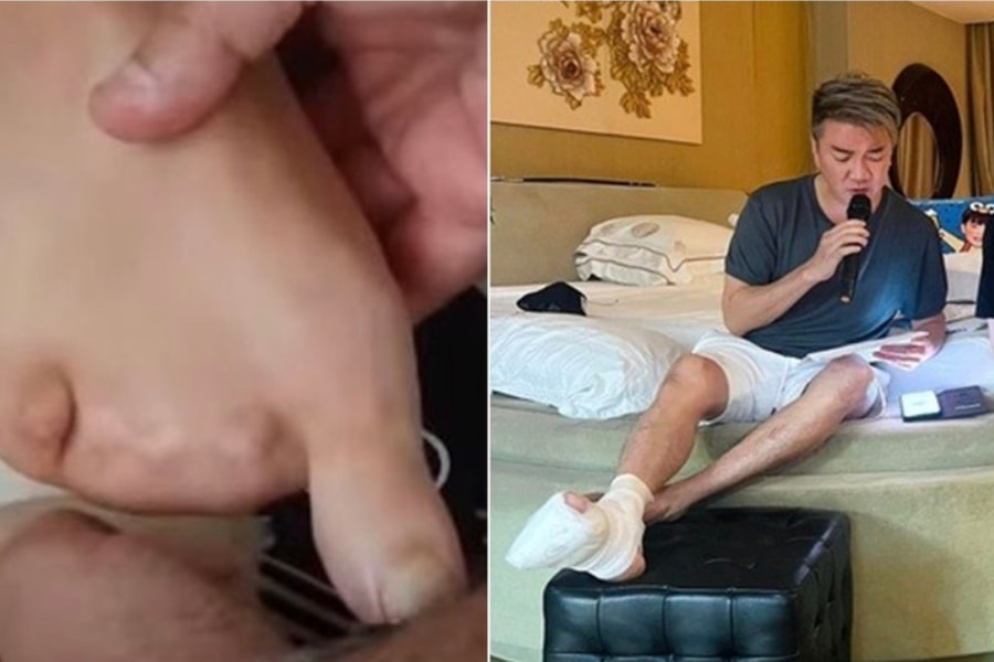Thông tin ca sĩ Đàm Vĩnh Hưng bị mất 4 ngón chân là sai sự thật