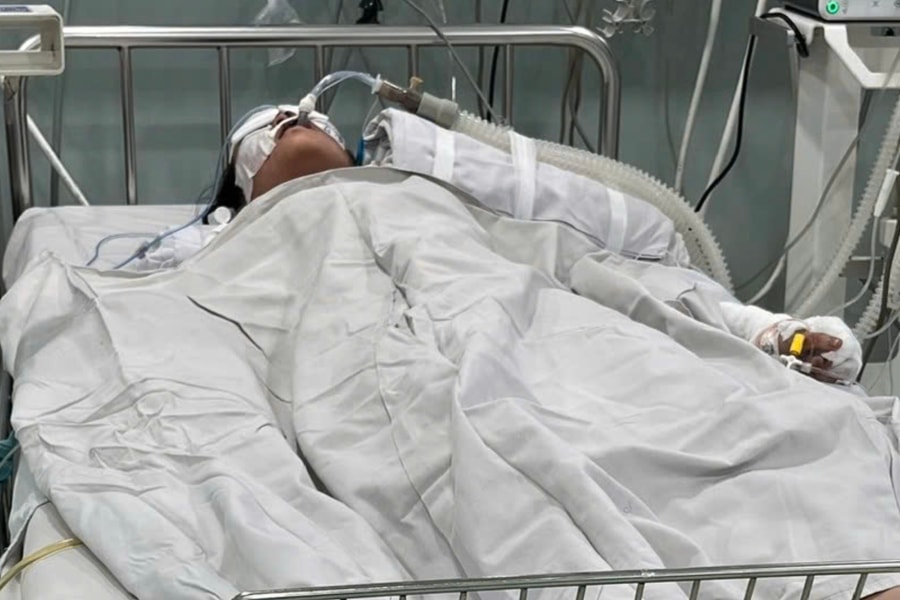 Vụ cháy tiệm bánh kem tại TP HCM: Nhiều nạn nhân đang thở máy, điều trị bỏng