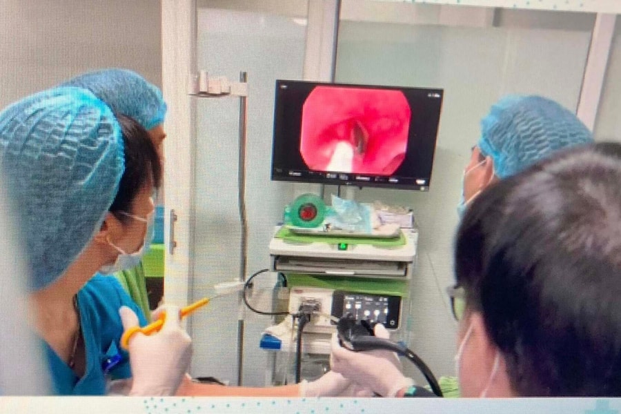 Lào Cai: Nội soi đưa con đỉa dài gần 8 cm ra khỏi khí quản bệnh nhân