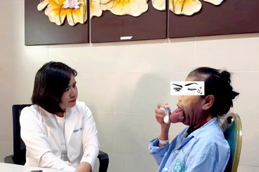 Người phụ nữ hơn 70 năm khổ sở vì dị tật lưỡi khổng lồ, được ‘giải thoát’ sau ca phẫu thuật