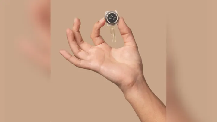 Người đàn ông mắc ALS có thể nói trở lại nhờ cấy ghép não Neuralink