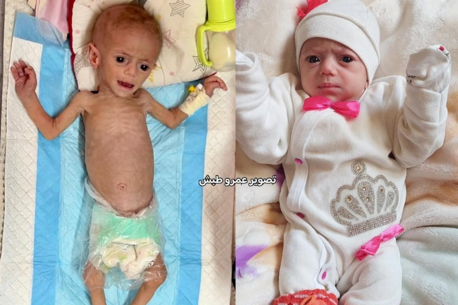 Bức ảnh gây chấn động thế giới: Câu chuyện đằng sau em bé Siwar Ashour ở Gaza