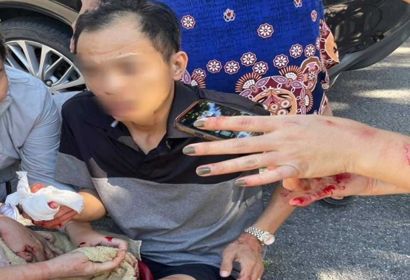 Chủ tịch công ty thuê giang hồ chém cổ đông để thâu tóm doanh nghiệp