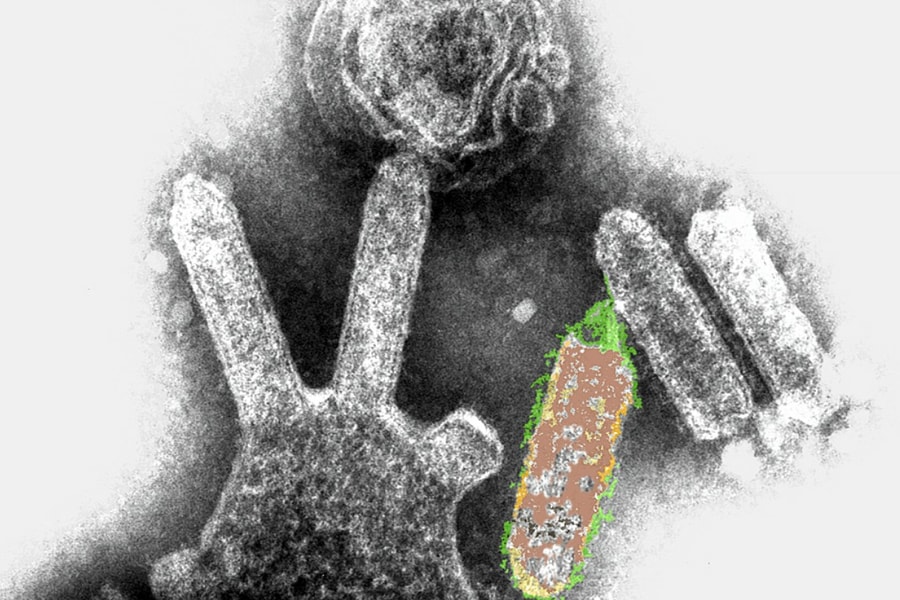 Người đàn ông Úc tử vong vì virus dơi nguy hiểm