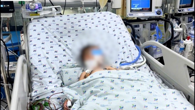 Cứu sống bé trai 23 tháng tuổi mắc tay chân miệng độ 3 nguy kịch, cận kề tử vong