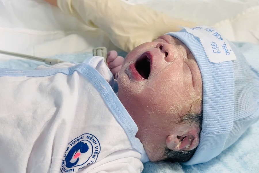 Bé trai TP HCM chào đời khoẻ mạnh bằng can thiệp bào thai