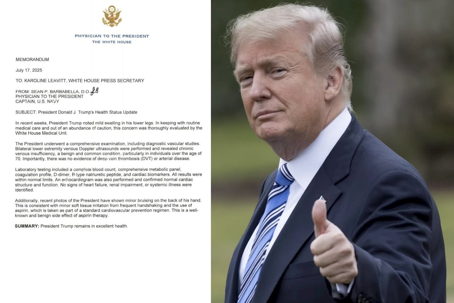 Ông Trump chỉ mắc bệnh tĩnh mạch gây sưng chân, sức khỏe hoàn toàn bình thường