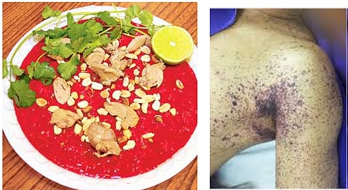 Hàng loạt vụ nhiễm liên cầu lợn: Đã đến lúc người dân cần thay đổi thói quen ăn uống