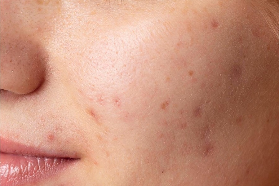 Thu hồi, tiêu hủy hàng loạt mỹ phẩm Image Skincare vì vi phạm nghiêm trọng nhãn mác, công thức