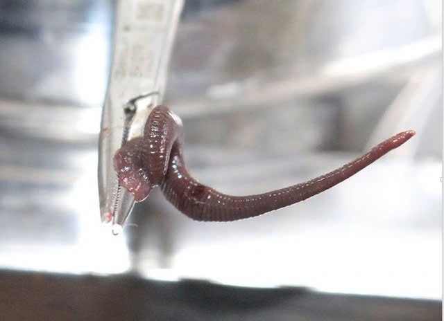 Gia Lai: Gắp con vắt dài 8cm sống trong mũi bệnh nhân suốt một tuần