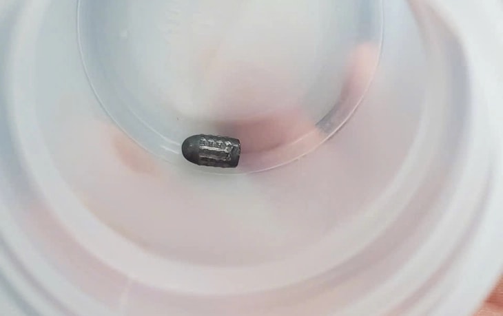 Người phụ nữ bị đạn lạc găm vào đầu khi đang làm vườn