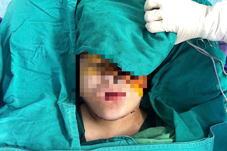 9 giờ phẫu thuật miễn phí cứu thiếu nữ Mông mang khối u khổng lồ