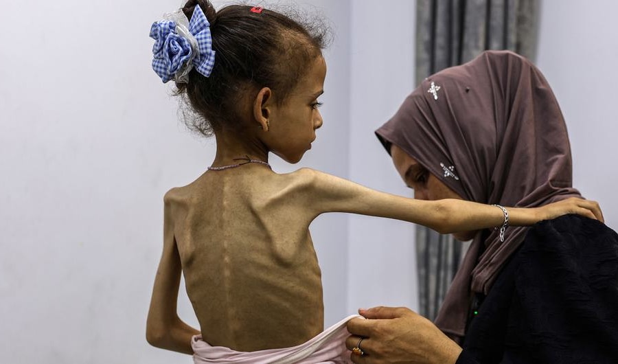 Nạn đói ở Gaza: 'Thảm họa nhân đạo chưa từng có' và 'thử thách của toàn nhân loại'