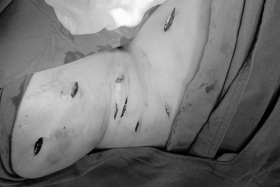 Đắk Lắk: Cứu sống người phụ nữ bị đâm 19 nhát khi đang ở nhà