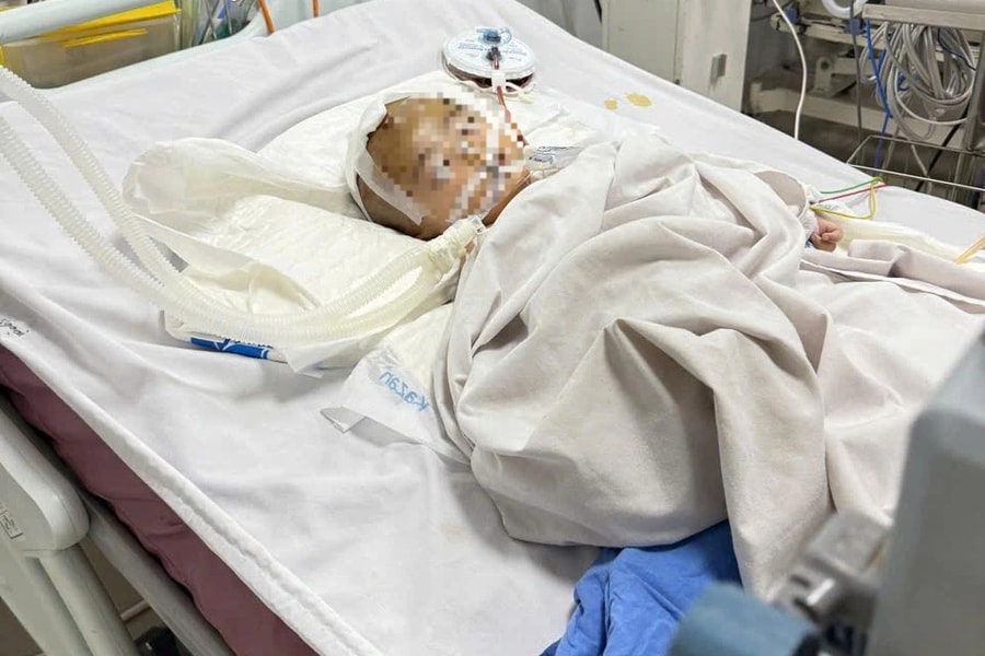 Xót xa bé trai 14 tháng tuổi bị bảo mẫu bạo hành đã không qua khỏi