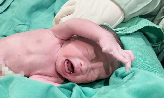 Kỳ tích y khoa: Cứu cả mẹ và con trong ca ung thư cổ tử cung khi mang thai