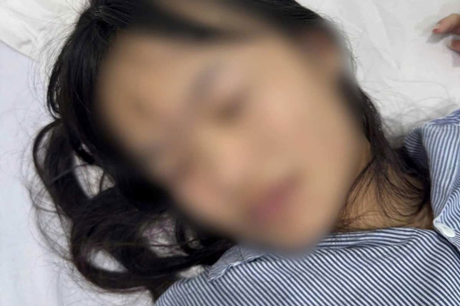 Nữ sinh cấp 2 nghi bị bạn đánh hội đồng