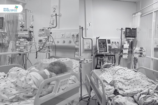 Bố phóng hỏa thiêu cả nhà, bé trai 5 tuổi bỏng 75%