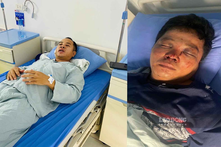 Giúp đỡ người gặp tai nạn, 2 anh em bị đánh nhập viện