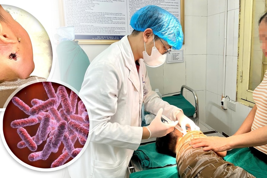 Bé 4 tuổi thoát chết vì vi khuẩn ăn thịt người