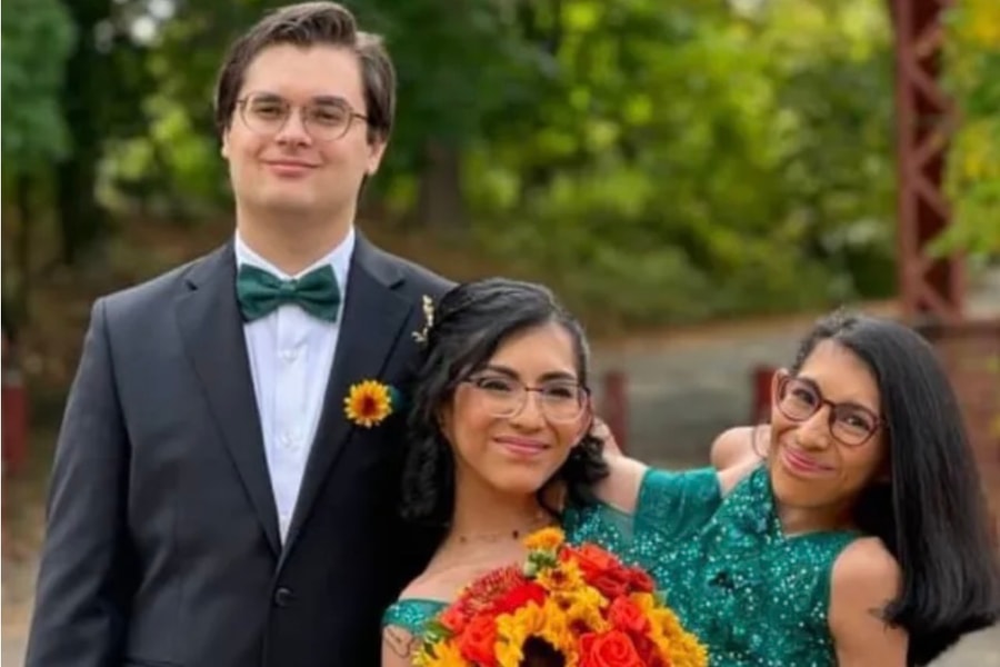 Chị em song sinh dính liền chia sẻ về việc một người lấy chồng