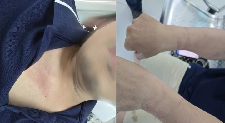 Phóng viên VOV Giao thông bị còng tay khi tác nghiệp tại hiện trường vụ cháy