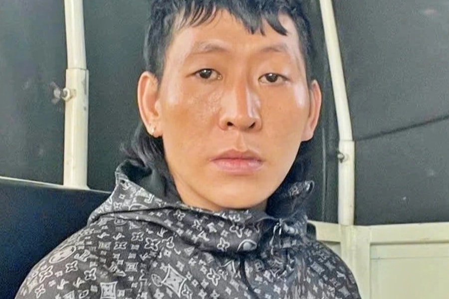 Anh trai bị người tình của em gái chém vào mặt gây thương tích nặng