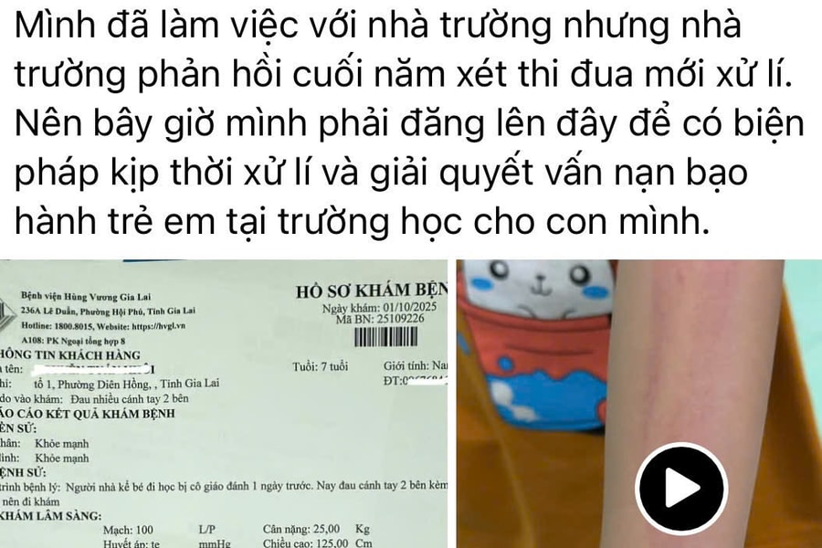 Gia Lai: Một giáo viên tiểu học bị tố có hành vi bạo lực đối với học sinh