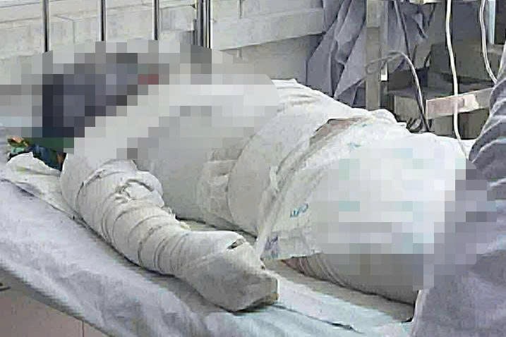 Gia Lai: Thêm 1 người nguy kịch trong vụ cháy nhà lúc rạng sáng, nghi do mâu thuẫn tình cảm