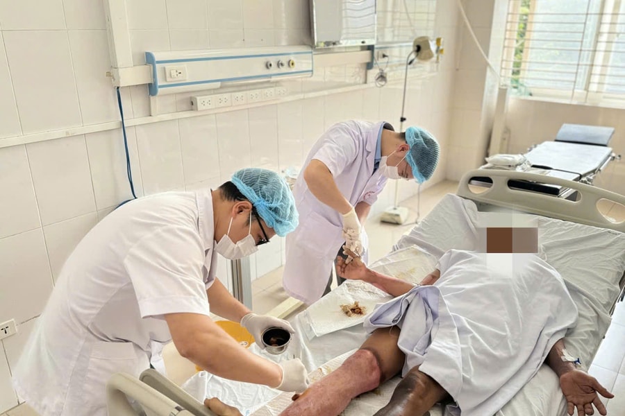 Không chạm vào điện vẫn bỏng nặng vì tia hồ quang nóng gấp 4 lần mặt trời