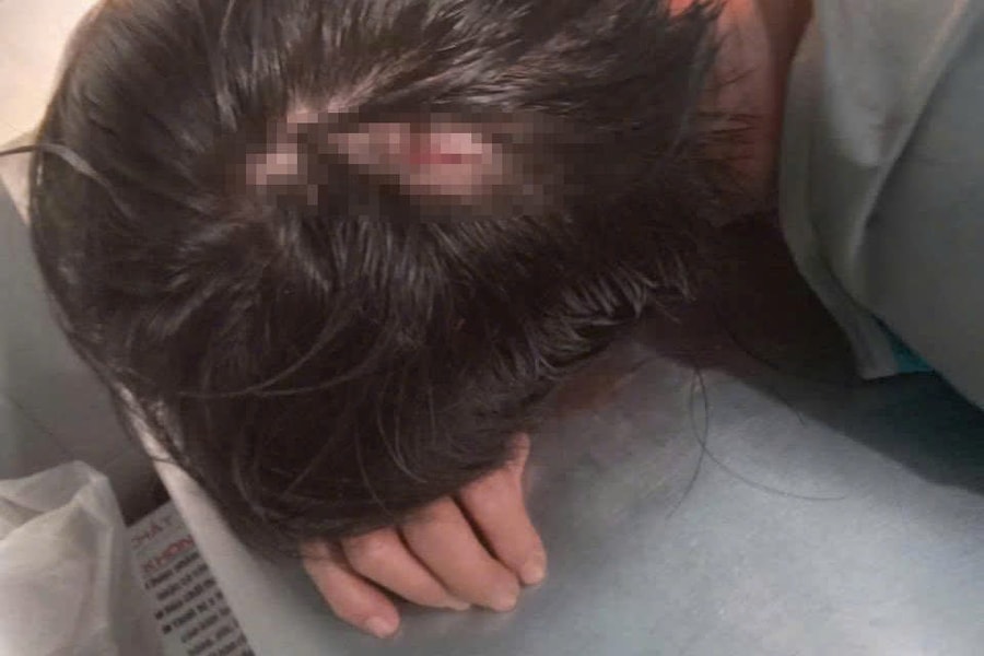 Gia Lai: Truy bắt đối tượng chém 2 người bị thương rồi bỏ trốn